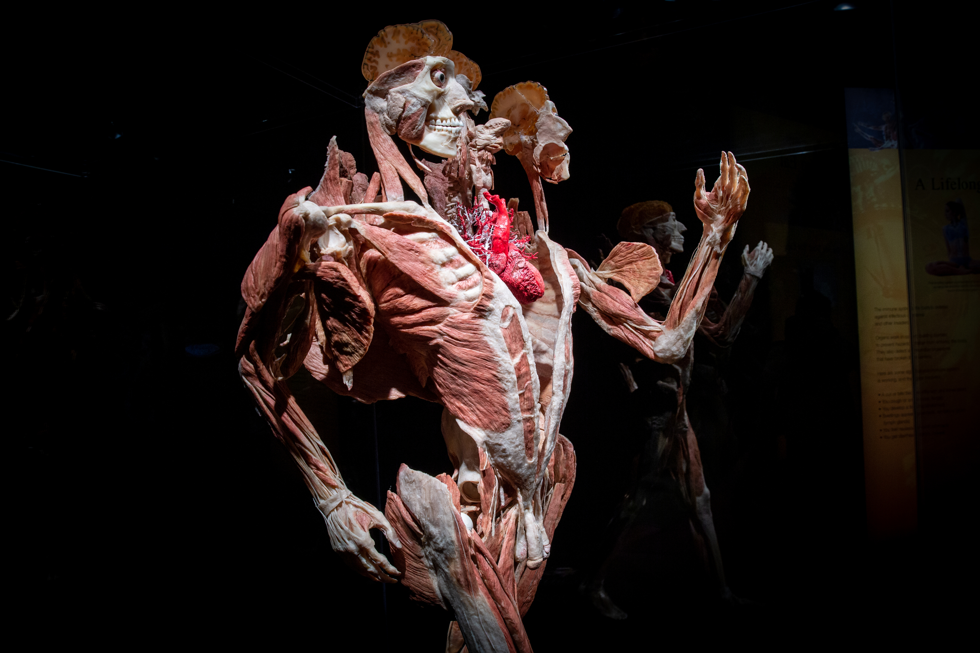 The Body Worlds exhibit "The Cycle of Life" has arrived at OMSI